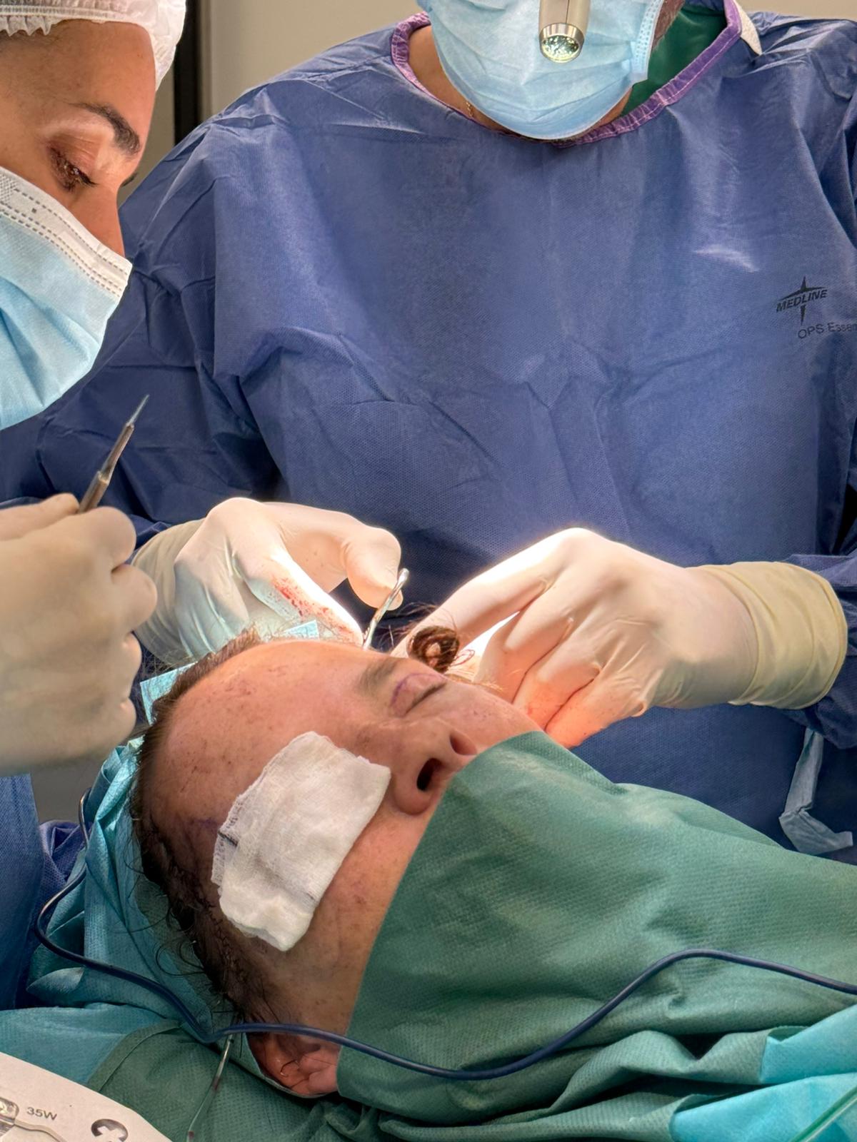 masc lift lifting temporal